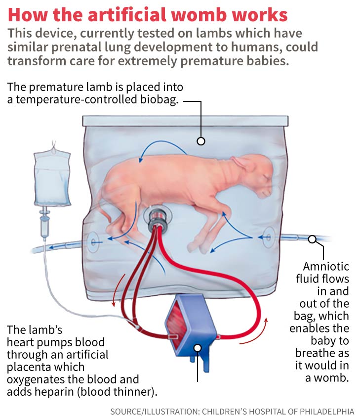 The Biobag: A Brave New World, Part 1 - Catholics for Choice